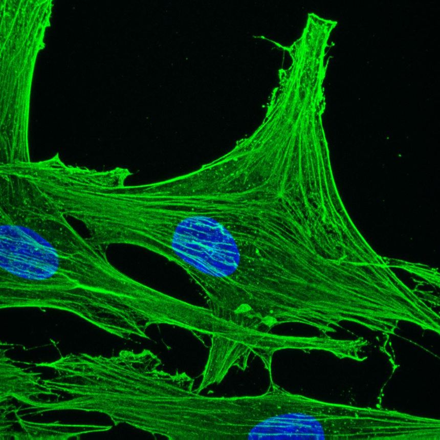 Figure 1. Methanol fixed human dermal fibroblasts immunostained with MUB0111P (2A3; 1:500)